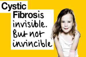 Cystic-fibrosis(2)